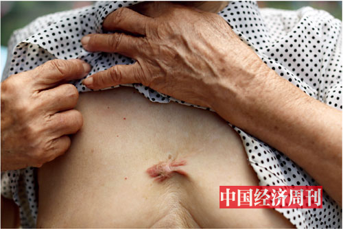 p22新梅片区村民向记者展示在2004 年强拆过程中遗留的伤痕。 《中国经济周刊》记者 胡巍| 摄