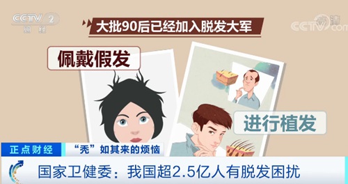 90后加入脱发大军,植发者年轻人居多,最适合做植发的人群是男性